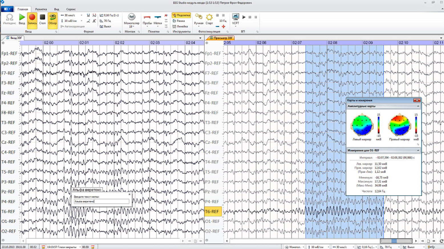 Mitsar EEG Studio report page showing multichannel EEG tracings and analysis panels